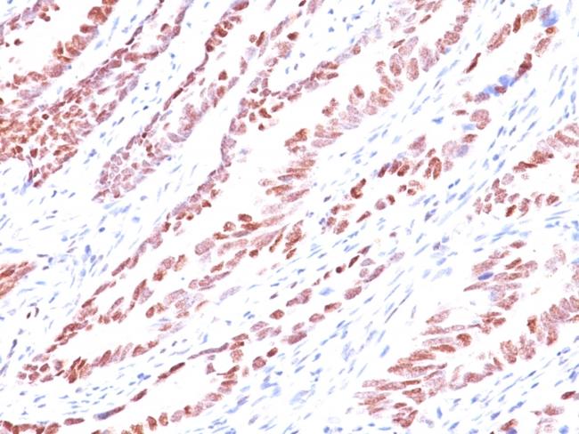 p57Kip2 (Mitotic Inhibitor/Suppressor Protein) Antibody in Immunohistochemistry (Paraffin) (IHC (P))