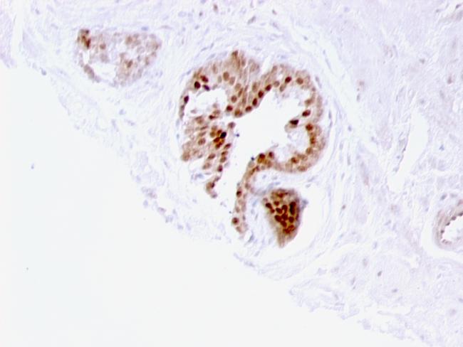 p57Kip2 (Mitotic Inhibitor/Suppressor Protein) Antibody in Immunohistochemistry (Paraffin) (IHC (P))