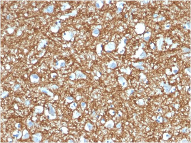 p14ARF Antibody in Immunohistochemistry (Paraffin) (IHC (P))