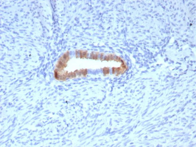 P16INK4a Antibody in Immunohistochemistry (Paraffin) (IHC (P))