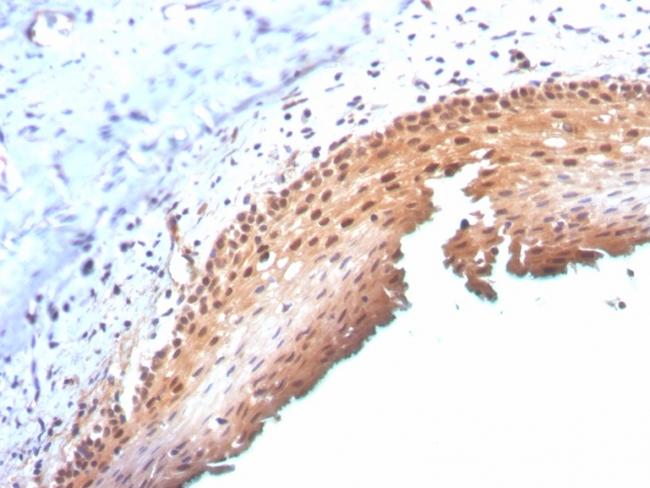 P16INK4a Antibody in Immunohistochemistry (Paraffin) (IHC (P))