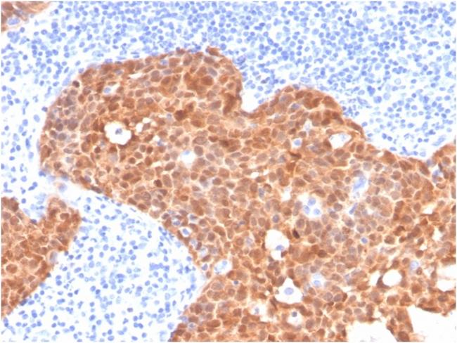 P16INK4a Antibody in Immunohistochemistry (Paraffin) (IHC (P))