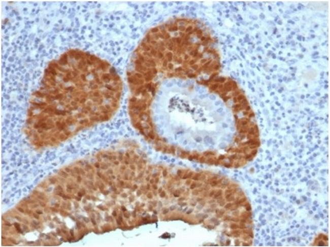 P16INK4a Antibody in Immunohistochemistry (Paraffin) (IHC (P))