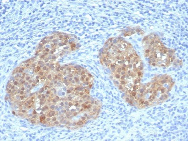 P16INK4a Antibody in Immunohistochemistry (Paraffin) (IHC (P))