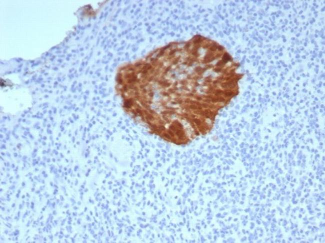 P16INK4a Antibody in Immunohistochemistry (Paraffin) (IHC (P))