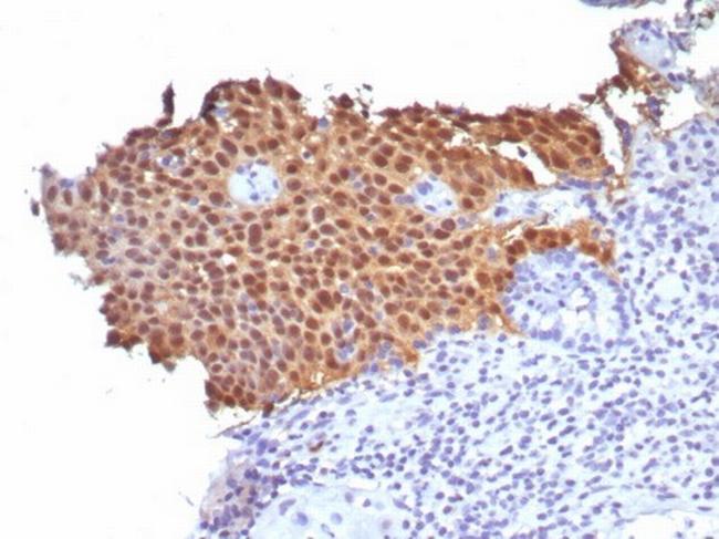 P16INK4a Antibody in Immunohistochemistry (Paraffin) (IHC (P))