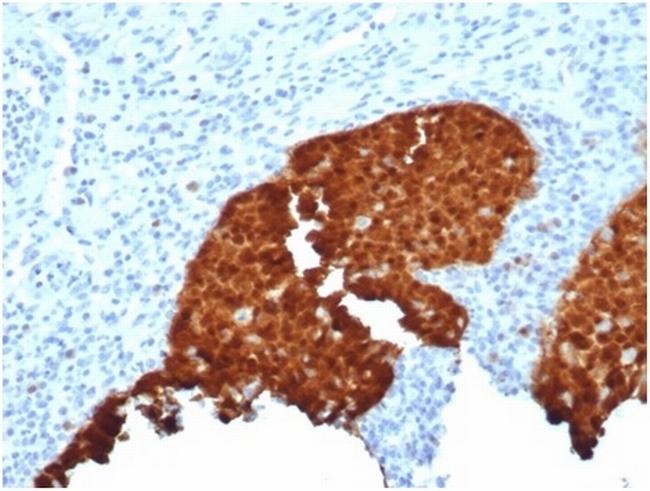 P16INK4a Antibody in Immunohistochemistry (Paraffin) (IHC (P))