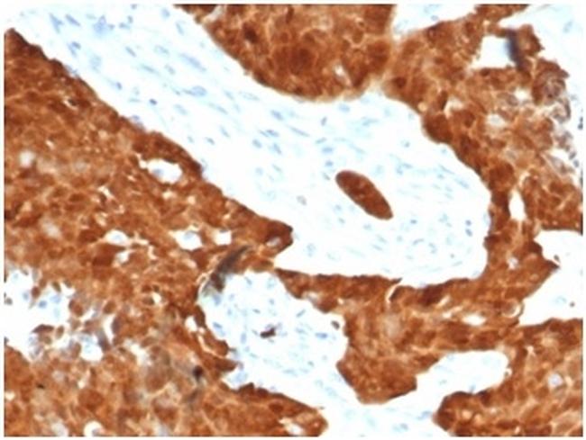 P16INK4a Antibody in Immunohistochemistry (Paraffin) (IHC (P))