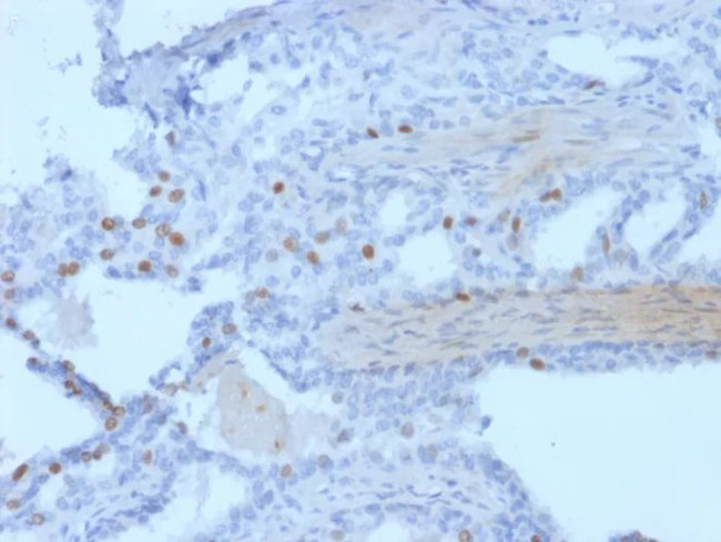 PCGF3 Antibody in Immunohistochemistry (Paraffin) (IHC (P))