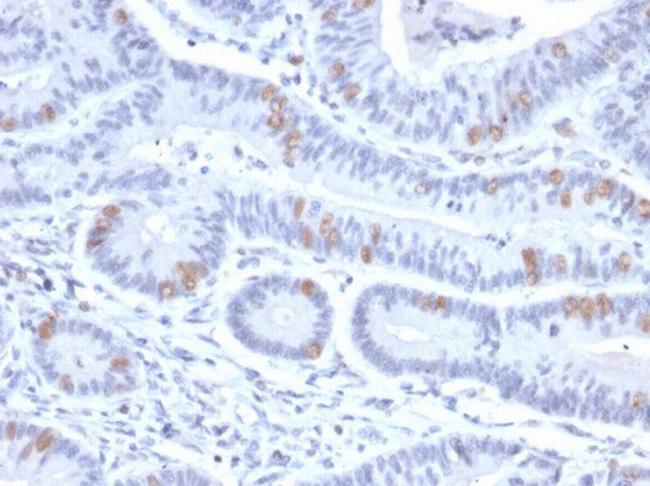 BRAF35/HMG20B Antibody in Immunohistochemistry (Paraffin) (IHC (P))