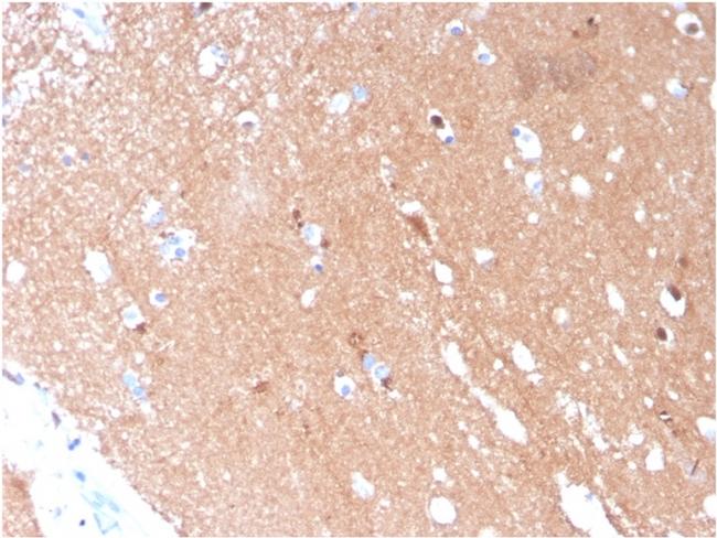 Tubulin beta 3/TUBB3 Antibody in Immunohistochemistry (Paraffin) (IHC (P))