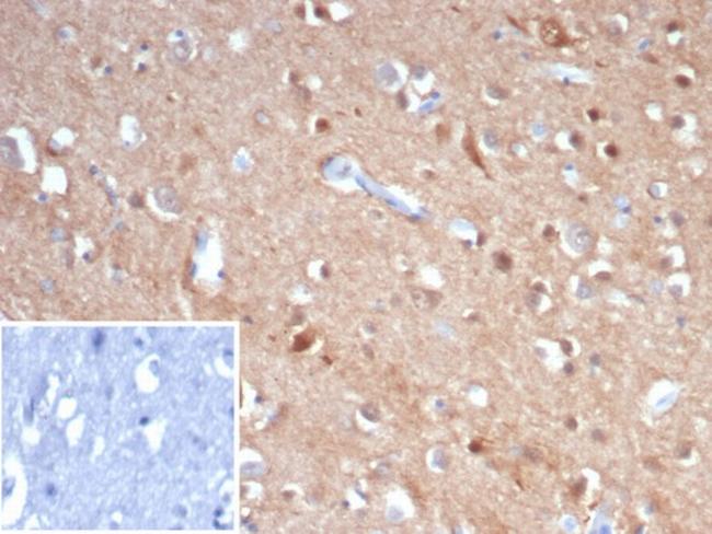 Tubulin beta 3/TUBB3 (Neuronal and Stem Cell Marker) Antibody in Immunohistochemistry (Paraffin) (IHC (P))