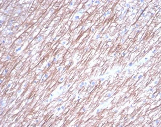 Tubulin beta 3/TUBB3 (Neuronal and Stem Cell Marker) Antibody in Immunohistochemistry (Paraffin) (IHC (P))