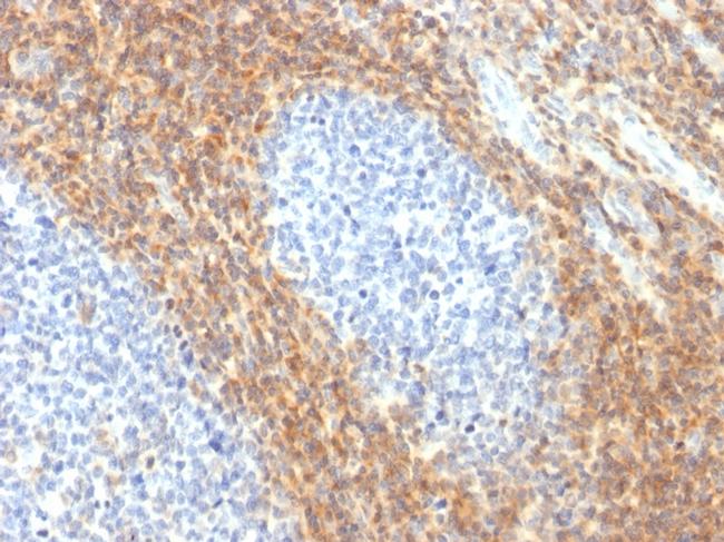 CD52 (Epididymis-Specific Protein 5) Antibody in Immunohistochemistry (Paraffin) (IHC (P))