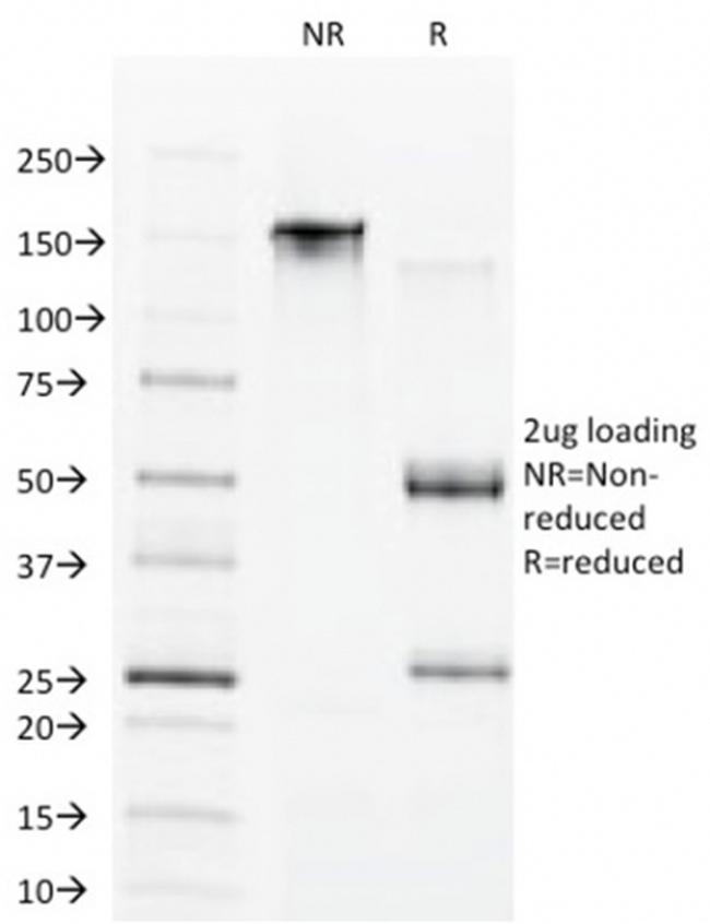 CDX1/Caudal Type Homeobox 1 (Intestine-Specific Transcription Factor) Antibody in SDS-PAGE (SDS-PAGE)