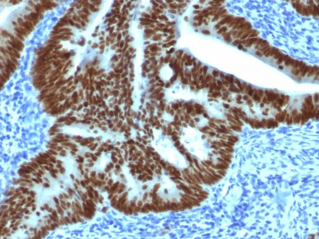 CDX2/Caudal Type Homeobox 2 (GI Epithelial Marker) Antibody in Immunohistochemistry (Paraffin) (IHC (P))