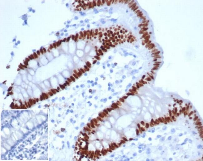 CDX2/Caudal Type Homeobox 2 (GI Epithelial Marker) Antibody in Immunohistochemistry (Paraffin) (IHC (P))