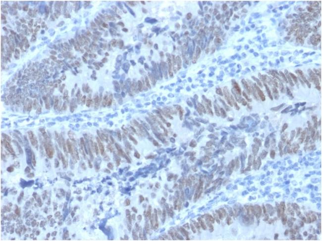 CDX2/Caudal Type Homeobox 2 (GI Epithelial Marker) Antibody in Immunohistochemistry (Paraffin) (IHC (P))