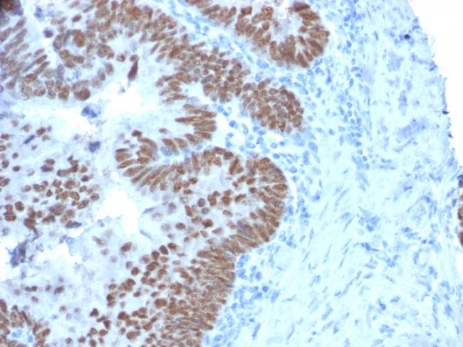 CDX2/Caudal Type Homeobox 2 (GI Epithelial Marker) Antibody in Immunohistochemistry (Paraffin) (IHC (P))