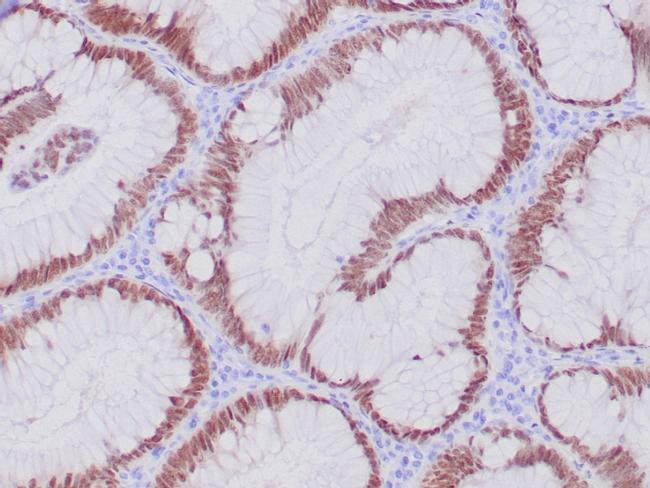 CDX2/Caudal Type Homeobox 2 Antibody in Immunohistochemistry (Paraffin) (IHC (P))