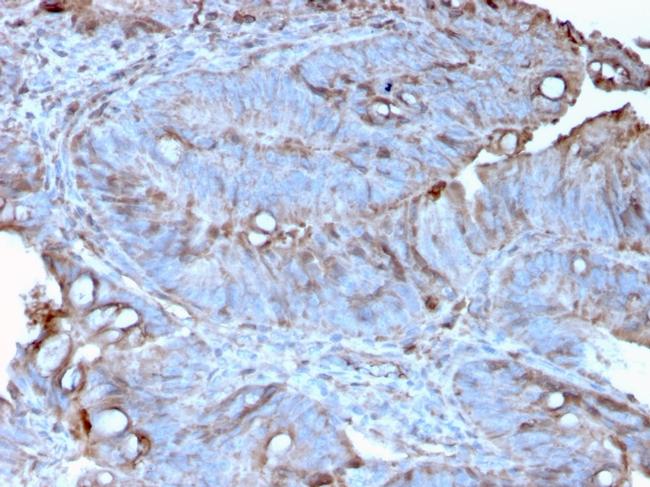 MerTK (Innate Immune Checkpoint) Antibody in Immunohistochemistry (Paraffin) (IHC (P))