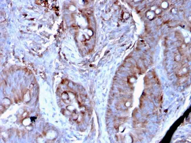 MerTK (Innate Immune Checkpoint) Antibody in Immunohistochemistry (Paraffin) (IHC (P))