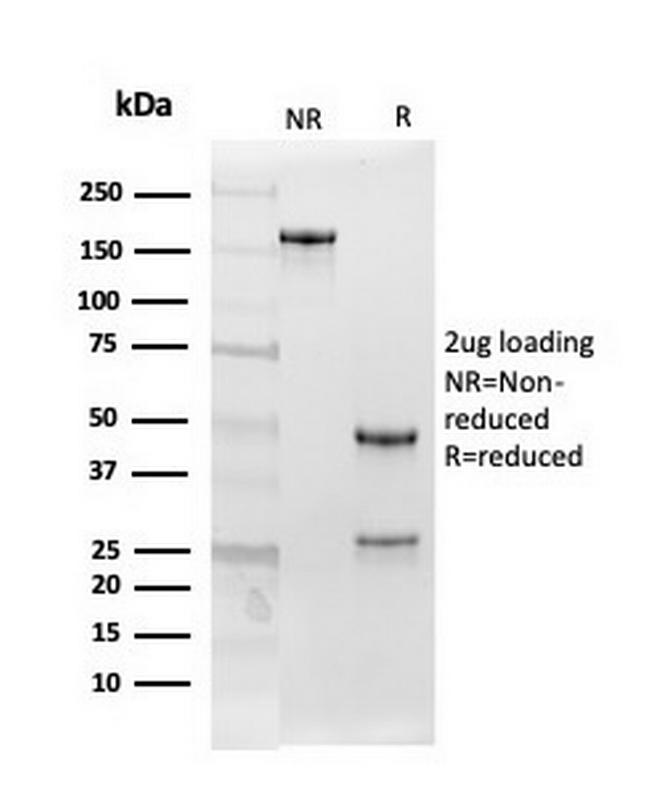 Follistatin/Activin Binding Protein Antibody in SDS-PAGE (SDS-PAGE)