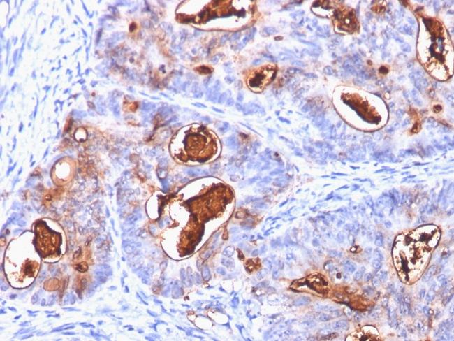 Carcinoembryonic Antigen (CEA)/CD66 Antibody in Immunohistochemistry (Paraffin) (IHC (P))