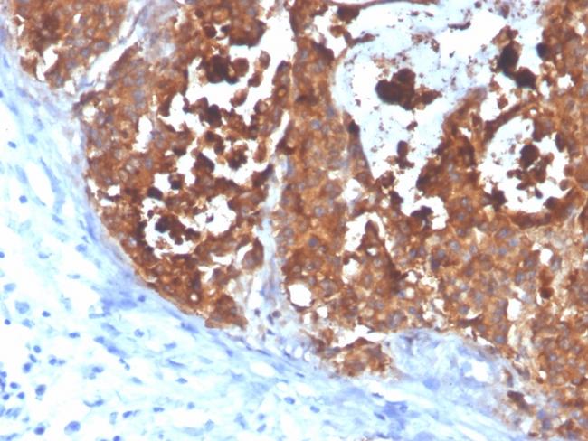 Carcinoembryonic Antigen (CEA)/CD66e Antibody in Immunohistochemistry (Paraffin) (IHC (P))