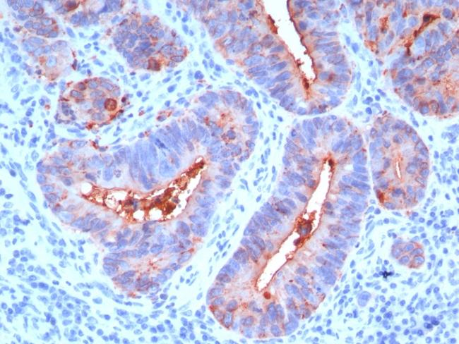 Carcinoembryonic Antigen (CEA)/CD66 Antibody in Immunohistochemistry (Paraffin) (IHC (P))