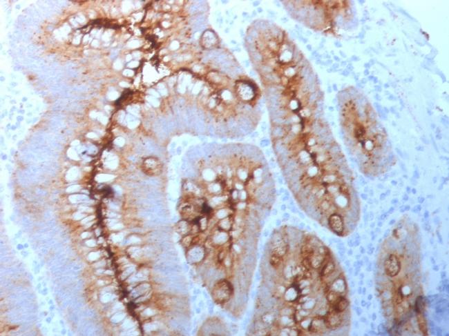 Carcinoembryonic Antigen (CEA)/CD66 Antibody in Immunohistochemistry (Paraffin) (IHC (P))