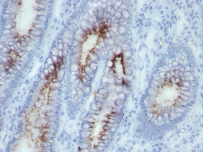 Carcinoembryonic Antigen (CEA)/CD66 Antibody in Immunohistochemistry (Paraffin) (IHC (P))