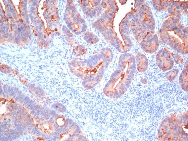 Carcinoembryonic Antigen, pan (CEA) Antibody in Immunohistochemistry (Paraffin) (IHC (P))