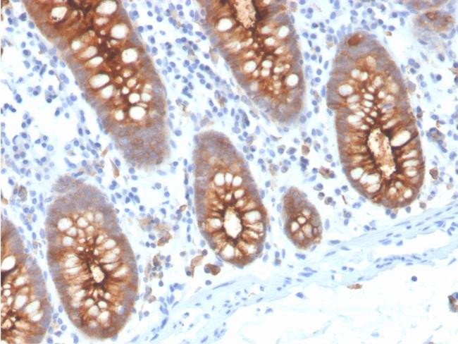 Carcinoembryonic Antigen (CEA)/CD66e Antibody in Immunohistochemistry (Paraffin) (IHC (P))