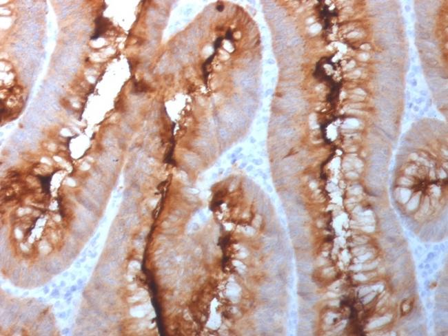 Carcinoembryonic Antigen (CEA)/CD66 Antibody in Immunohistochemistry (Paraffin) (IHC (P))