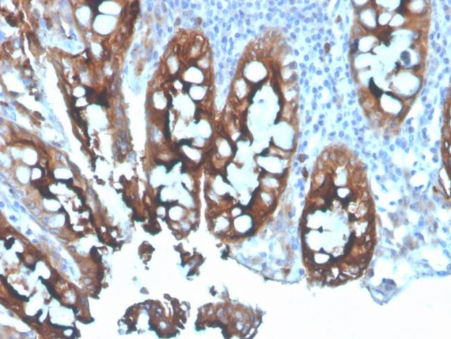 Carcinoembryonic Antigen (CEA)/CD66e Antibody in Immunohistochemistry (Paraffin) (IHC (P))