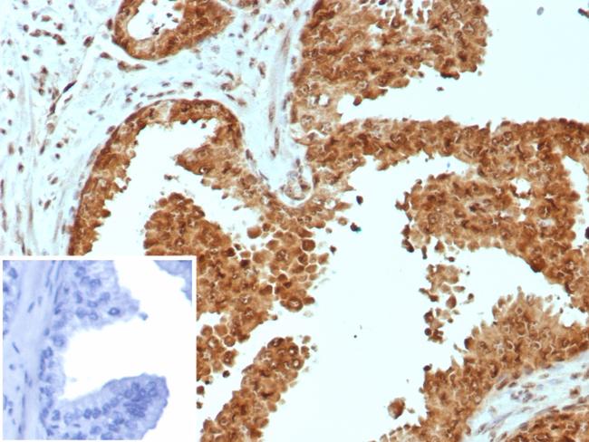 CARM1 Antibody in Immunohistochemistry (Paraffin) (IHC (P))