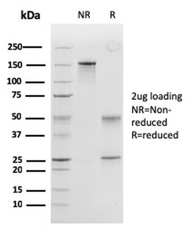 Peroxiredoxin 4 (Prognostic Marker for Lung SqCC) Antibody in SDS-PAGE (SDS-PAGE)