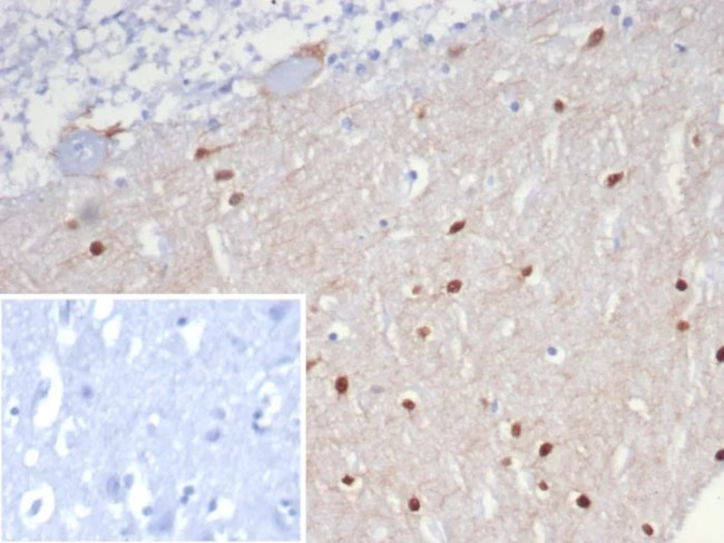 SCGN/Secretagogin Antibody in Immunohistochemistry (Paraffin) (IHC (P))