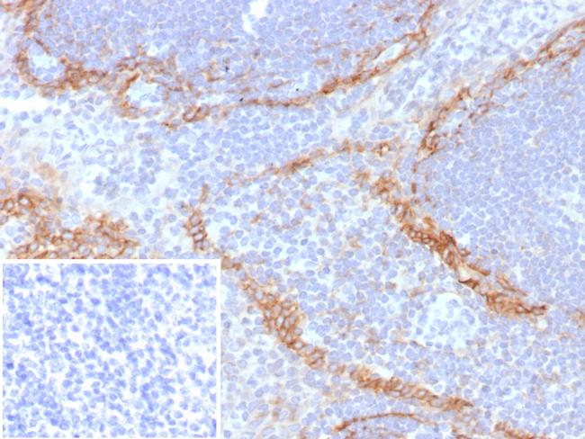 Podoplanin (PDPN) (Lymphatic Endothelial and Mesothelial Marker) Antibody in Immunohistochemistry (Paraffin) (IHC (P))