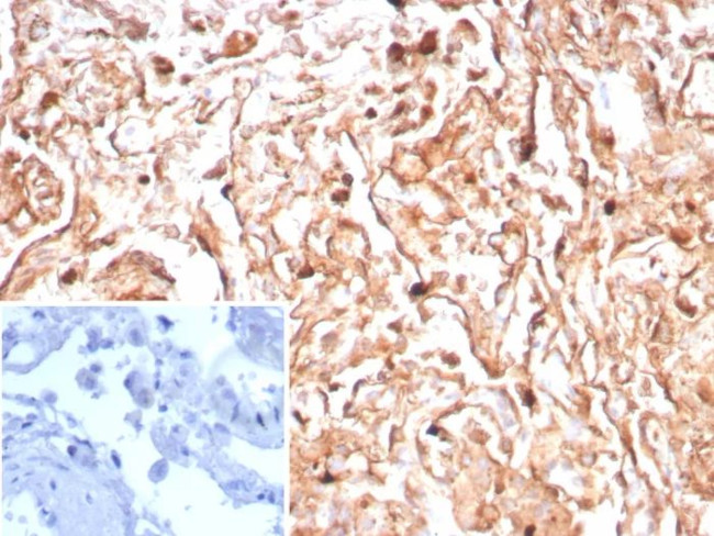 Podoplanin (PDPN) (Lymphatic Endothelial and Mesothelial Marker) Antibody in Immunohistochemistry (Paraffin) (IHC (P))