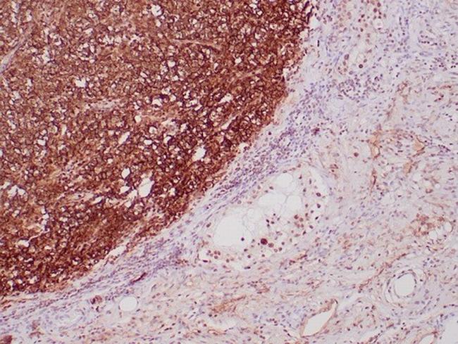 Podoplanin (PDPN) (Lymphatic Endothelial and Mesothelial Marker) Antibody in Immunohistochemistry (Paraffin) (IHC (P))