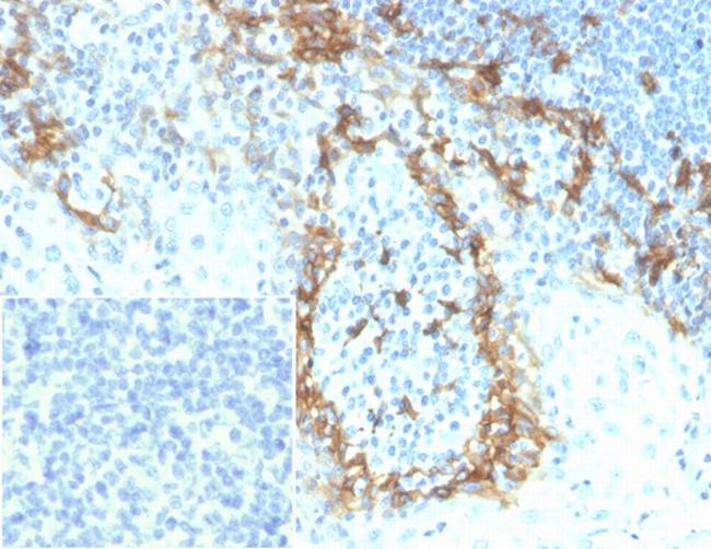 Podoplanin (PDPN) (Lymphatic Endothelial and Mesothelial Marker) Antibody in Immunohistochemistry (Paraffin) (IHC (P))