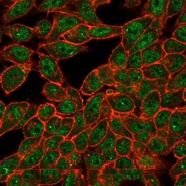 CELF2/CUGBP2 (RNA-binding protein) Antibody in Immunocytochemistry (ICC/IF)