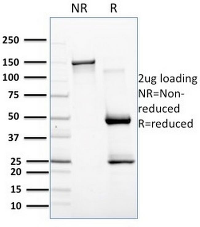 CD257/BAFF/TNFSF13B Antibody in SDS-PAGE (SDS-PAGE)