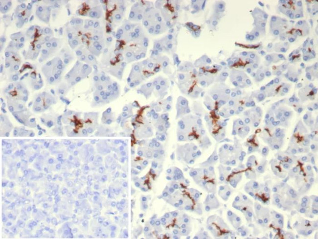 CFTR (Cystic Fibrosis Transmembrane Conductance Regulator) Antibody in Immunohistochemistry (Paraffin) (IHC (P))