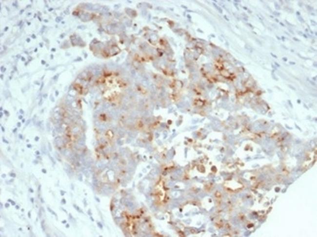 CFTR (Cystic Fibrosis Transmembrane Conductance Regulator) Antibody in Immunohistochemistry (Paraffin) (IHC (P))