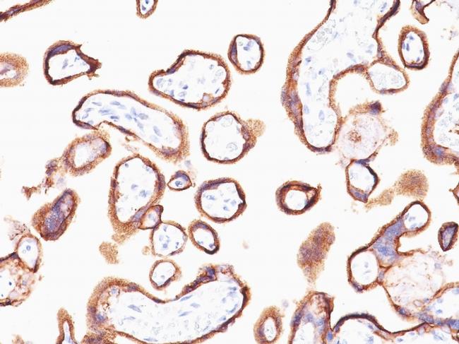 HCG-alpha Antibody in Immunohistochemistry (Paraffin) (IHC (P))