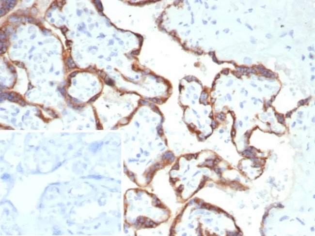 HCG-beta (Pregnancy and Choriocarcinoma Marker) Antibody in Immunohistochemistry (Paraffin) (IHC (P))