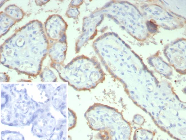 HCG-beta (Pregnancy and Choriocarcinoma Marker) Antibody in Immunohistochemistry (Paraffin) (IHC (P))